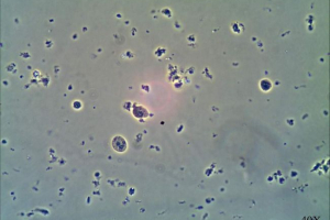 Дизентеріал ameba. Опис небезпечного паразиту Дизентеріал ameba. Опис небезпечного паразиту