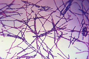 Біологічна зброя: визначення, збудники, розподіл, захист та приклади Біологічна зброя: визначення, збудники, розподіл, захист та приклади