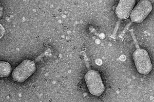 Топ 7 факти про віруси вбивства бактерій - бактеріофаги Топ 7 факти про віруси вбивства бактерій - бактеріофаги